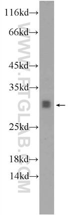 TPD52L2 Antibody in Western Blot (WB)