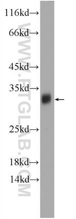 TPD52L2 Antibody in Western Blot (WB)