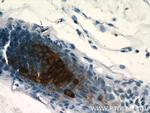 CRNN Antibody in Immunohistochemistry (Paraffin) (IHC (P))