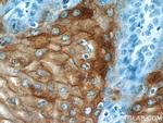 CRNN Antibody in Immunohistochemistry (Paraffin) (IHC (P))