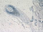 CRNN Antibody in Immunohistochemistry (Paraffin) (IHC (P))
