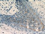 CRNN Antibody in Immunohistochemistry (Paraffin) (IHC (P))