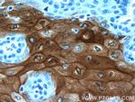 CRNN Antibody in Immunohistochemistry (Paraffin) (IHC (P))