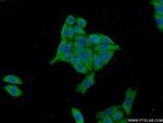 S100P Antibody in Immunocytochemistry (ICC/IF)