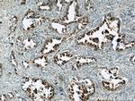 S100P Antibody in Immunohistochemistry (Paraffin) (IHC (P))