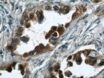 S100P Antibody in Immunohistochemistry (Paraffin) (IHC (P))