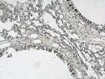 S100P Antibody in Immunohistochemistry (Paraffin) (IHC (P))