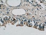 S100P Antibody in Immunohistochemistry (Paraffin) (IHC (P))