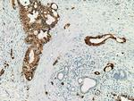 S100P Antibody in Immunohistochemistry (Paraffin) (IHC (P))