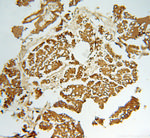 CAPZA1 Antibody in Immunohistochemistry (Paraffin) (IHC (P))