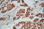 CAPZA1 Antibody in Immunohistochemistry (Paraffin) (IHC (P))