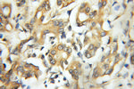 CAPZA1 Antibody in Immunohistochemistry (Paraffin) (IHC (P))