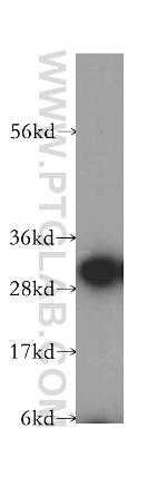 CAPZA1 Antibody in Western Blot (WB)