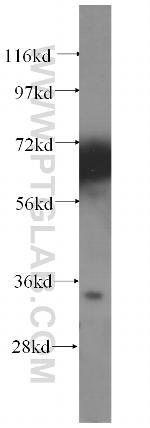 CYB5R1 Antibody in Western Blot (WB)