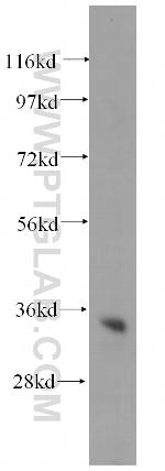 CYB5R1 Antibody in Western Blot (WB)