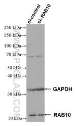 RAB10 Antibody in Western Blot (WB)