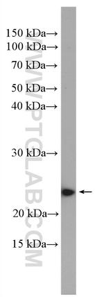 RAB10 Antibody in Western Blot (WB)