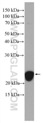 RAB10 Antibody in Western Blot (WB)