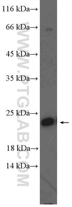 RAB10 Antibody in Western Blot (WB)