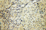 SIRP BETA 1 Antibody in Immunohistochemistry (Paraffin) (IHC (P))