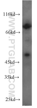 SIRP BETA 1 Antibody in Western Blot (WB)
