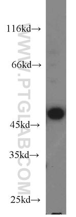 SIRP BETA 1 Antibody in Western Blot (WB)