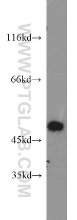 SIRP BETA 1 Antibody in Western Blot (WB)