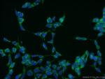 CILP2 Antibody in Immunocytochemistry (ICC/IF)