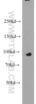 CILP2 Antibody in Western Blot (WB)