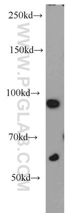 CILP2 Antibody in Western Blot (WB)