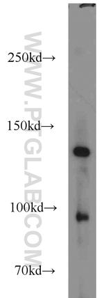 CILP2 Antibody in Western Blot (WB)