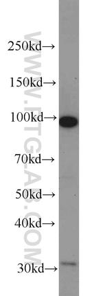 CILP2 Antibody in Western Blot (WB)