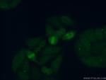 RFC3 Antibody in Immunocytochemistry (ICC/IF)