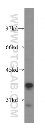 RFC3 Antibody in Western Blot (WB)