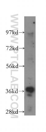 RFC3 Antibody in Western Blot (WB)