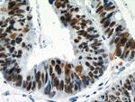 NOLC1 Antibody in Immunohistochemistry (Paraffin) (IHC (P))