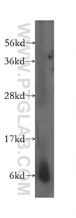 SS18L2 Antibody in Western Blot (WB)