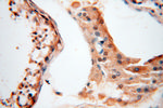 ANKRD2 Antibody in Immunohistochemistry (Paraffin) (IHC (P))