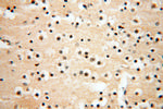 ANKRD2 Antibody in Immunohistochemistry (Paraffin) (IHC (P))
