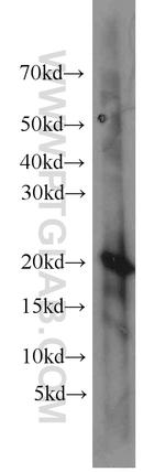 CIB1 Antibody in Western Blot (WB)