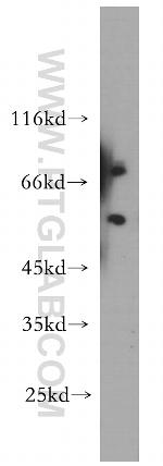 RAG2 Antibody in Western Blot (WB)