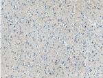 ARPP-21 Antibody in Immunohistochemistry (Paraffin) (IHC (P))