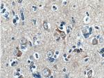 ARPP-21 Antibody in Immunohistochemistry (Paraffin) (IHC (P))
