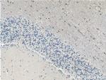 ARPP-21 Antibody in Immunohistochemistry (Paraffin) (IHC (P))
