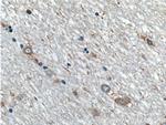 ARPP-21 Antibody in Immunohistochemistry (Paraffin) (IHC (P))