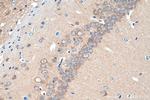 ARPP-21 Antibody in Immunohistochemistry (Paraffin) (IHC (P))