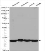 UBE2K Antibody in Western Blot (WB)