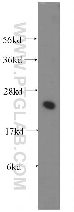 UBE2K Antibody in Western Blot (WB)