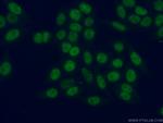 MLF2 Antibody in Immunocytochemistry (ICC/IF)