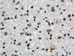 MLF2 Antibody in Immunohistochemistry (Paraffin) (IHC (P))